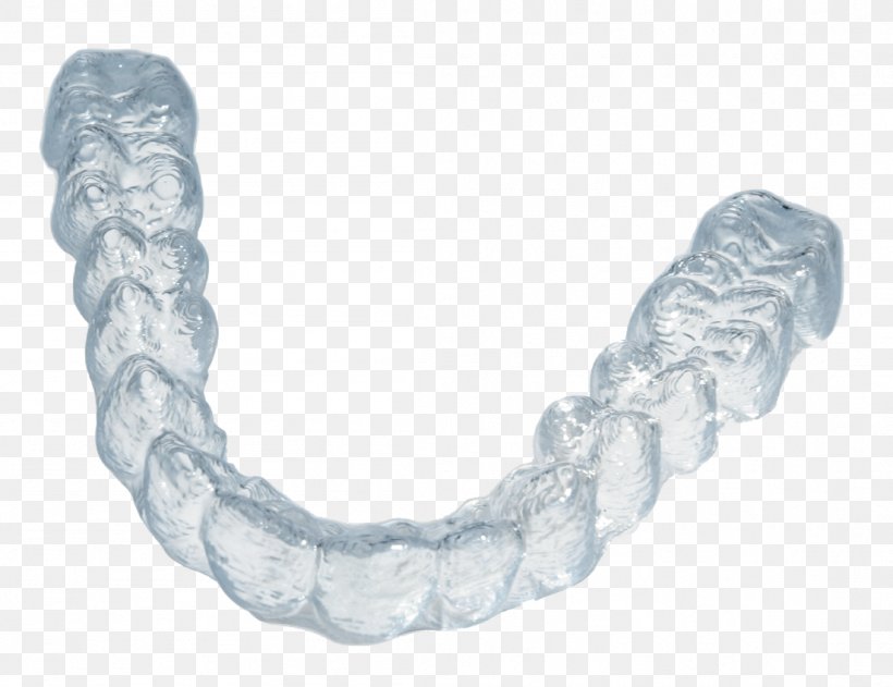 Clear Aligners Retainer Orthodontics Dentistry Dental Braces, PNG, 1102x849px, Clear Aligners, Chain, Clinic, Dental Braces, Dental Floss Download Free