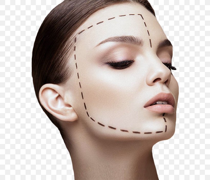 Plastic Surgery Elite Body Contouring Rhytidectomy High-intensity Focused Ultrasound, PNG, 580x700px, Surgery, Aesthetic Medicine, Beauty, Botulinum Toxin, Cheek Download Free