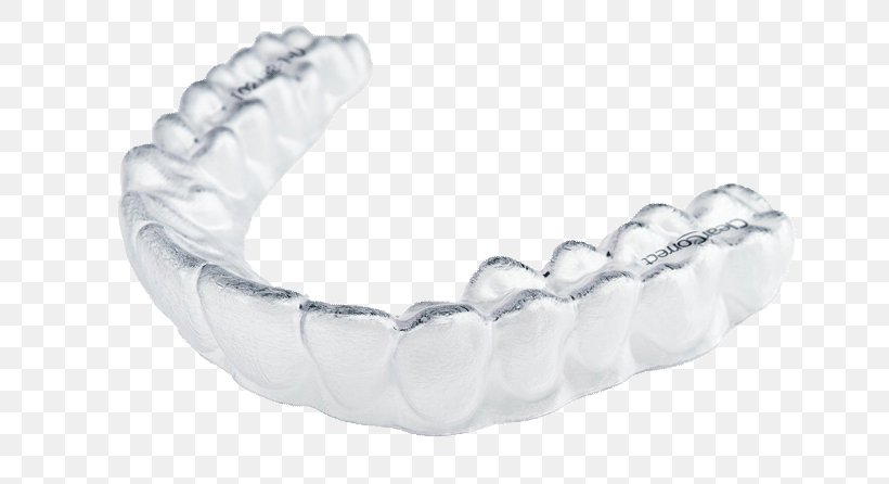 Cosmetic Dentistry Clear Aligners Orthodontics, PNG, 660x446px, Dentist, Body Jewelry, Bracelet, Chain, Clear Aligners Download Free