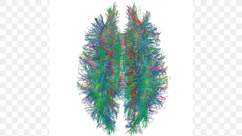White Matter Brain Human Connectome Project Central Nervous System, PNG, 640x463px, White Matter, Aquarium Decor, Brain, Central Nervous System, Connectome Download Free