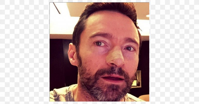 Hugh Jackman The Wolverine Sunscreen Skin Cancer Actor, PNG, 1200x630px, Hugh Jackman, Actor, Basalcell Carcinoma, Beard, Cancer Download Free