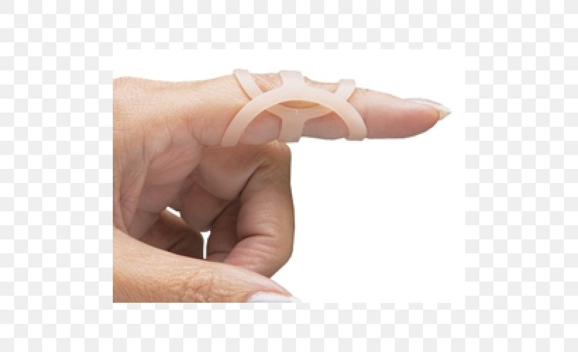 Thumb Spica Splint Finger Arthritis, PNG, 500x500px, Thumb, Arthritis, Ear, Finger, Hand Download Free