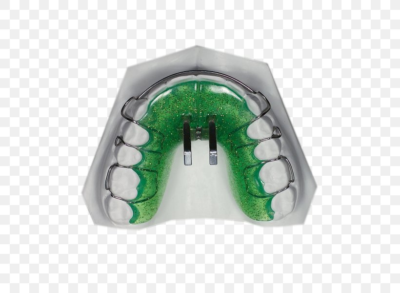 Vorschubdoppelplatte Orthodontics Dental Braces Aktive Platte Jaw, PNG, 748x600px, Orthodontics, Dental Braces, Industrial Design, Jaw, Laboratory Download Free