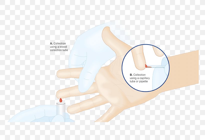 Thumb Medical Glove Hand Model, PNG, 870x595px, Thumb, Arm, Ear, Finger, Glove Download Free