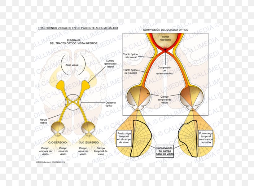 Acromegaly Nose Paper Human Behavior Body, PNG, 600x600px, Watercolor, Cartoon, Flower, Frame, Heart Download Free