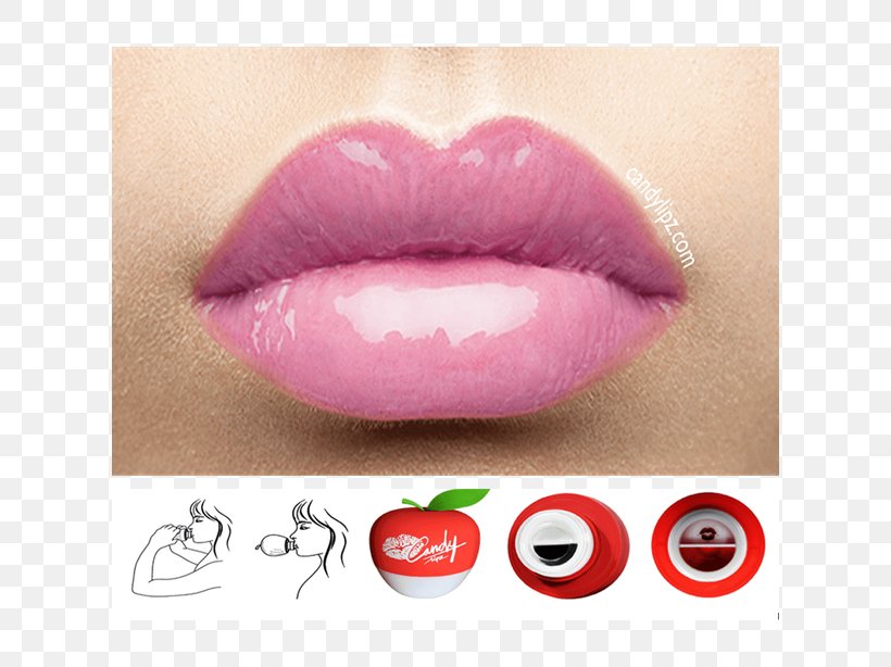 Lip Augmentation Cosmetics Face Restylane, PNG, 614x614px, Lip Augmentation, Cosmetics, Eyelash, Face, Gel Download Free