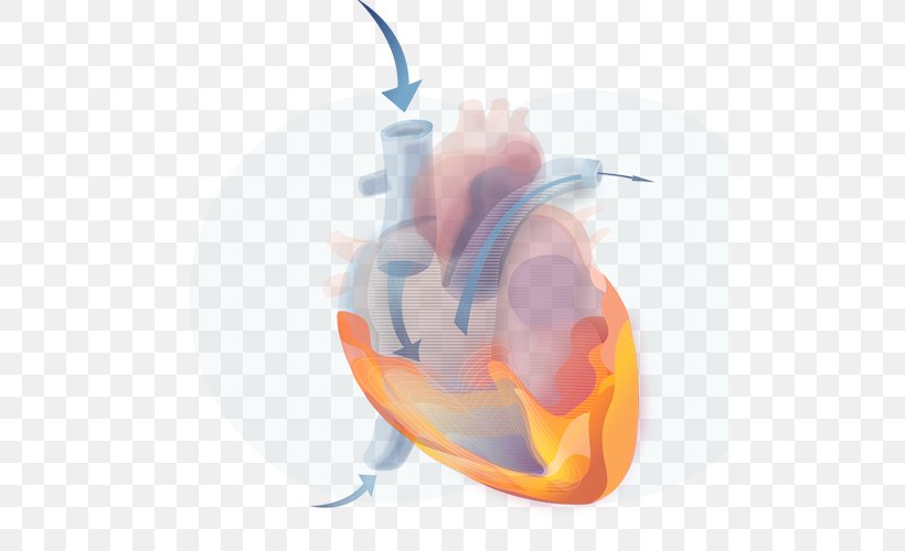 Cardiovascular Disease Diabetes Mellitus Heart Myocardial Infarction, PNG, 500x500px, Cardiovascular Disease, Comorbidity, Computer, Death, Diabetes Mellitus Download Free