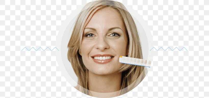 Bleach Tooth Whitening Cosmetic Dentistry, PNG, 760x385px, Bleach, Beauty, Blond, Brown Hair, Cheek Download Free