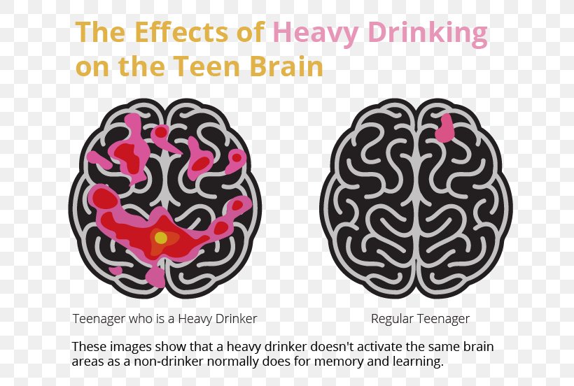 Brain Alcoholism Alcoholic Drink Alcohol And Health Binge Drinking, PNG, 699x552px, Watercolor, Cartoon, Flower, Frame, Heart Download Free