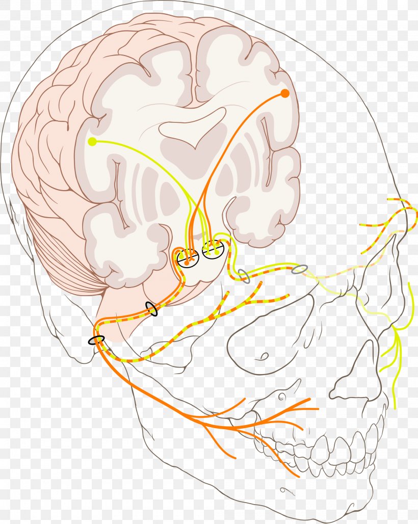 Facial Nerve Paralysis Bell's Palsy Cranial Nerves, PNG, 2000x2509px, Watercolor, Cartoon, Flower, Frame, Heart Download Free