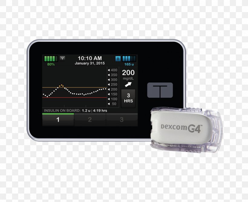 Dexcom Continuous Glucose Monitor Insulin Pump Blood Glucose Monitoring Diabetes Mellitus, PNG, 898x732px, Dexcom, Animas Corporation, Blood, Blood Glucose Monitoring, Blood Sugar Download Free