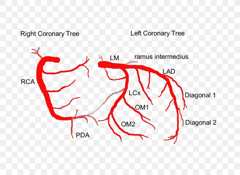 Coronary Arteries Anatomy Coronary Circulation Anterior Interventricular Branch Of Left Coronary Artery Heart, PNG, 750x600px, Watercolor, Cartoon, Flower, Frame, Heart Download Free