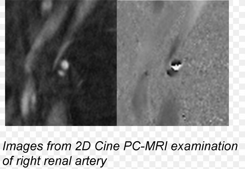 Radiology Phenomenon White Angle Font, PNG, 1642x1135px, Radiology, Black And White, Monochrome, Monochrome Photography, Phenomenon Download Free