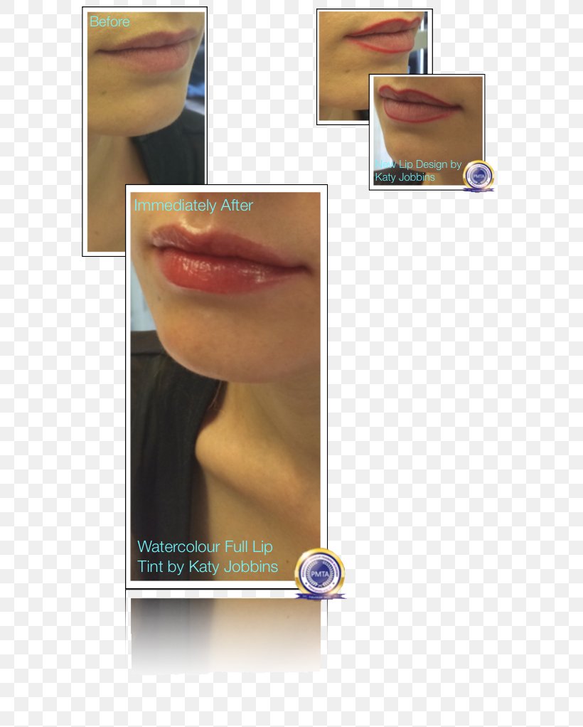 Lip, PNG, 604x1022px, Lip, Chin, Eyelash, Jaw, Nail Download Free