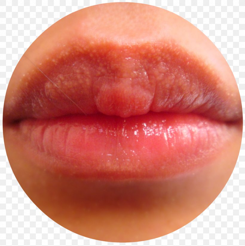Lip Balm Mouth Lipstick Lip Gloss, PNG, 1818x1824px, Lip, Close Up, Color, Cosmetics, Dyschromia Download Free