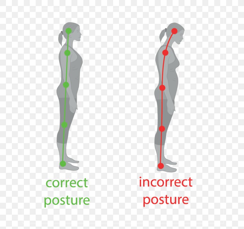 Neutral Spine Poor Posture Standing Human Body Vertebral Column, PNG, 768x768px, Neutral Spine, Arm, Back Pain, Diagram, Flat Feet Download Free