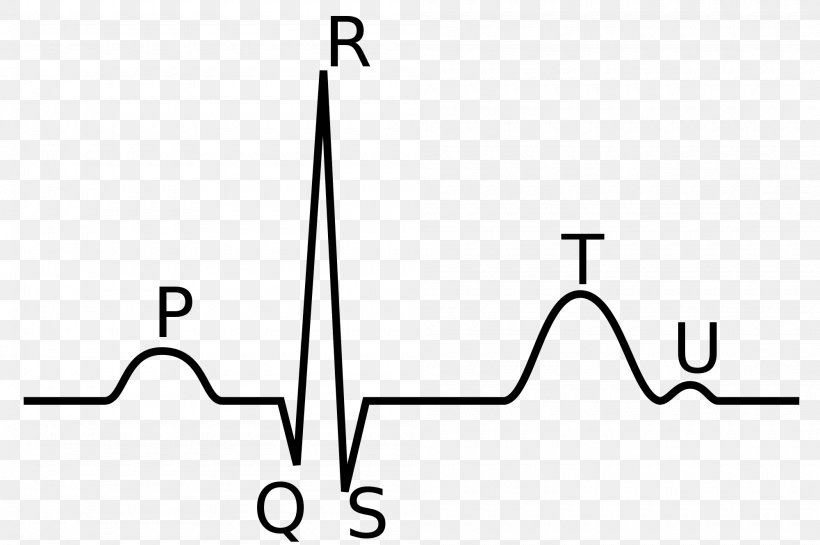 QRS Complex Electrocardiography P Wave Heart Depolarization, PNG, 2000x1331px, Qrs Complex, Area, Atrium, Black And White, Cardiology Download Free