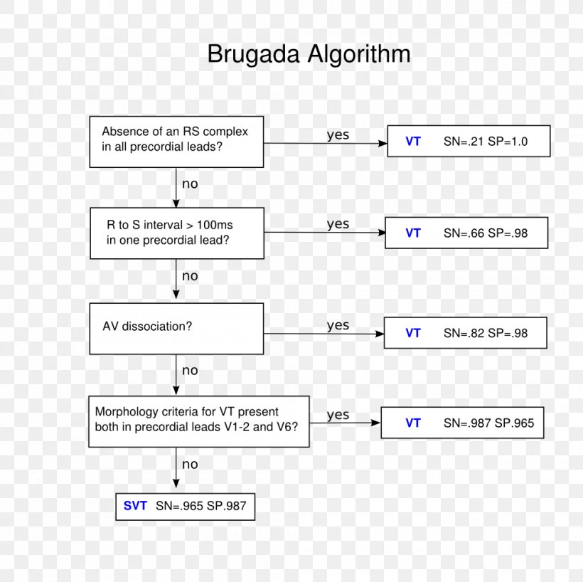 Brugada Syndrome Electrocardiography Screenshot Medical Diagnosis, PNG, 1000x998px, Brugada Syndrome, Algorithm, Area, Brand, Diagram Download Free