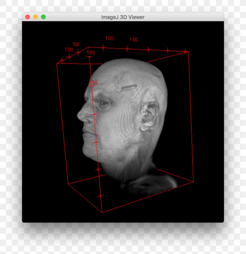 Nose Medical Imaging Human Behavior Homo Sapiens Jaw, PNG, 1248x1292px, Nose, Behavior, Brain, Ear, Face Download Free