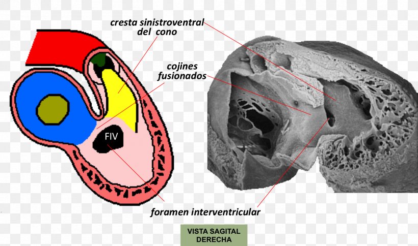 Interventricular Septum Primary Interventricular Foramen Embriologia Humana Interventricular Foramina Embryology, PNG, 1463x865px, Watercolor, Cartoon, Flower, Frame, Heart Download Free