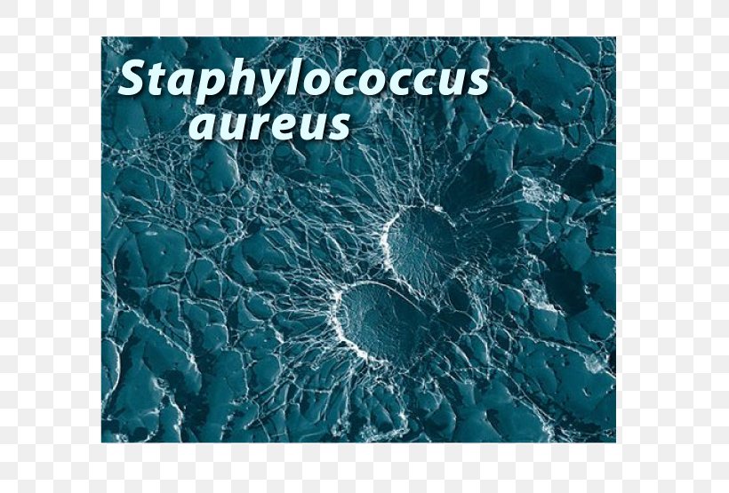 Staphylococcus Aureus Bacteria Infection Disease Strain, PNG, 790x555px, Staphylococcus Aureus, Antibiotics, Aqua, Bacteria, Blue Download Free