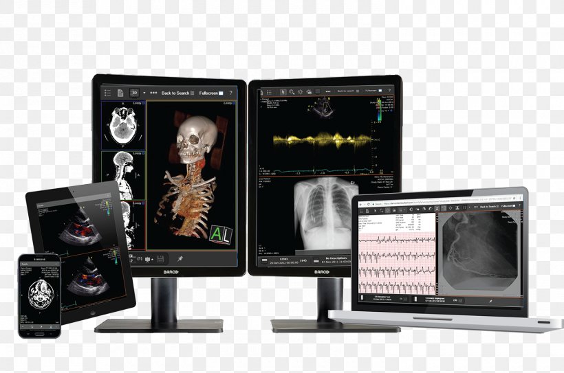 Client Outlook Inc. Health Care Medical Diagnosis Medical Imaging Business, PNG, 1500x995px, Health Care, Business, Computer Software, Display Device, Electronics Download Free
