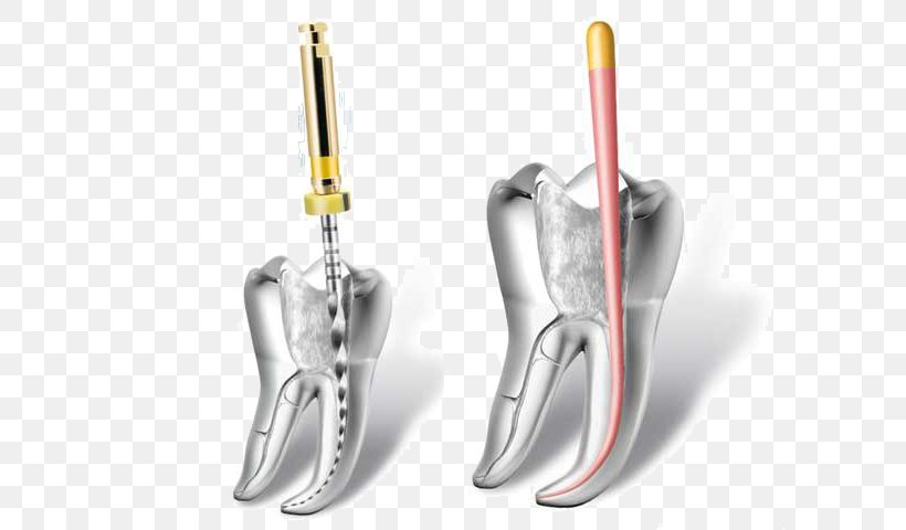 Endodontic Therapy Endodontics Root Canal Dentistry, PNG, 600x480px, Endodontic Therapy, Clinic, Dental Surgery, Dentist, Dentistry Download Free