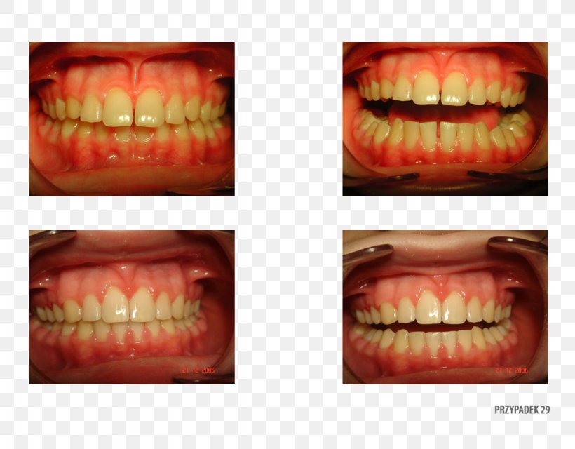 Orange Polska Tooth Patient Therapy, PNG, 1024x800px, Orange, Clinic, Closeup, Jaw, Lip Download Free