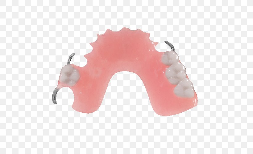 Dentures Removable Partial Denture Dentistry Dental Laboratory Jaw, PNG, 501x500px, Dentures, Allure Dental Lab, Clinic, Cosmetic Dentistry, Dental Laboratory Download Free