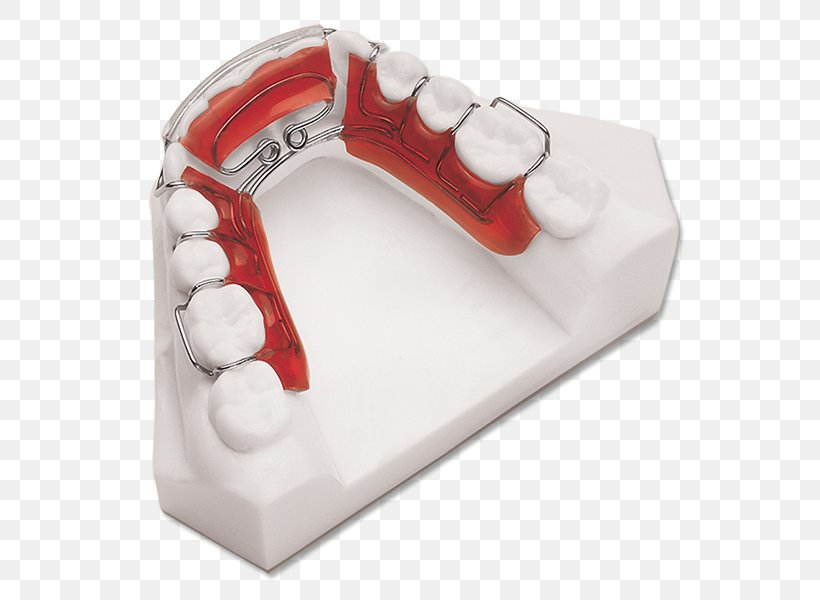 Retainer Orthodontics Mandible Dentistry Algún Lugar Profundo, PNG, 588x600px, Retainer, Adviser, Dentistry, Hardware, Heart Download Free