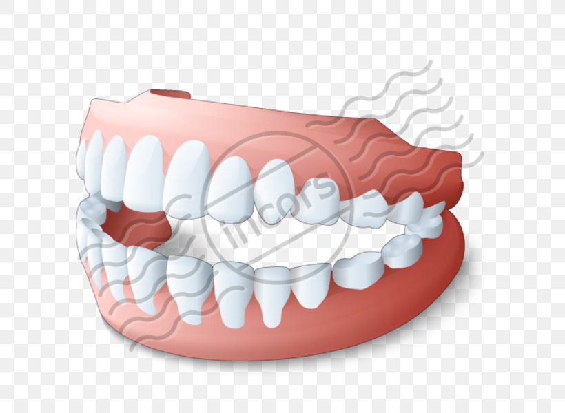 Toothbrush Dentures Dentistry Removable Partial Denture, PNG, 600x600px, Tooth, Dental Implant, Dental Restoration, Dentistry, Dentures Download Free