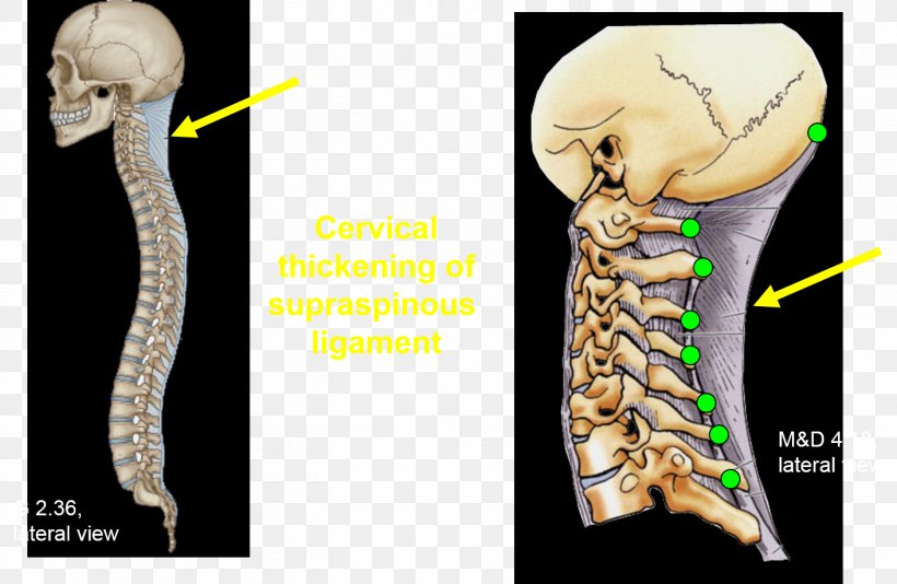 Shoulder Skeleton Organism, PNG, 1411x919px, Shoulder, Arm, Bone, Jaw, Joint Download Free