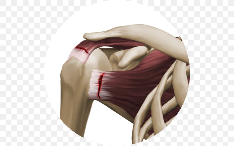 Shoulder Knee, PNG, 512x513px, Shoulder, Arm, Joint, Knee, Neck Download Free