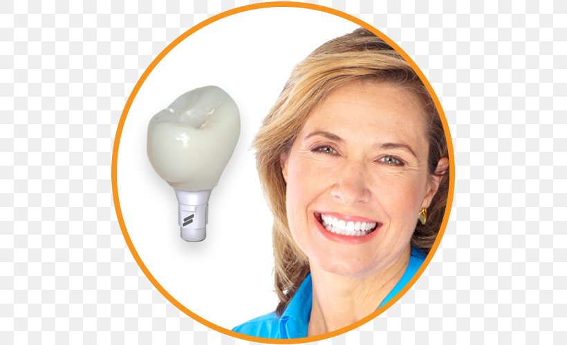Tooth Dental Implant Dentistry, PNG, 500x500px, Tooth, Bridge, Chin, Cosmetic Dentistry, Dental Implant Download Free