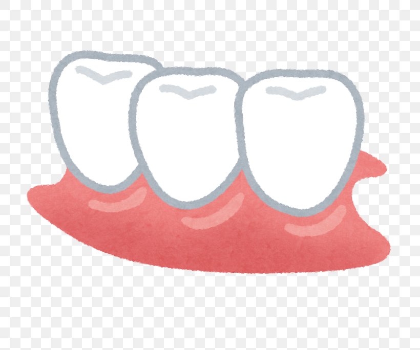 Dentures Dentist Tooth Removable Partial Denture Therapy, PNG, 752x684px, Dentures, Dental Calculus, Dental Hygienist, Dental Implant, Dentist Download Free