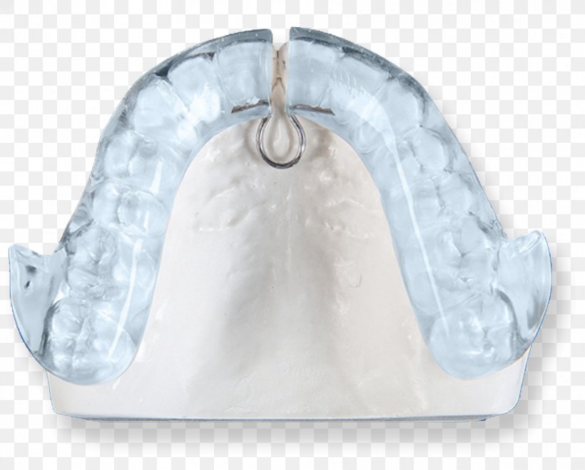 Jaw Dentistry Surgery Tooth Orthodontics, PNG, 950x763px, Jaw, Bruxism, Dental Public Health, Dentistry, Endodontics Download Free