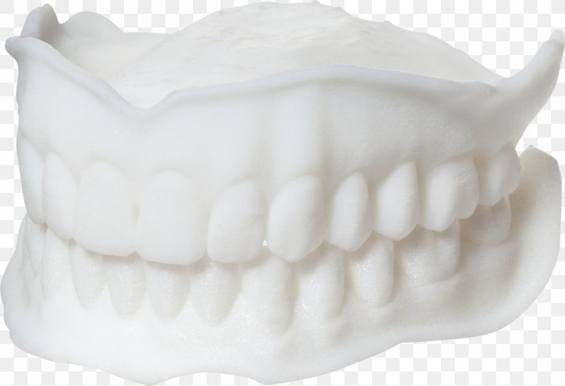 Dentures Tooth Dental Laboratory 3D Printing, PNG, 1000x685px, 3d Computer Graphics, 3d Printing, Dentures, Cheque, Dental Laboratory Download Free