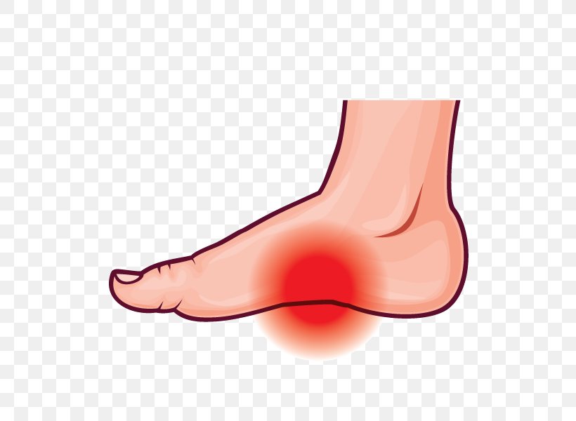 Thumb Arches Of The Foot Podalgia Plantar Fasciitis, PNG, 600x600px, Watercolor, Cartoon, Flower, Frame, Heart Download Free