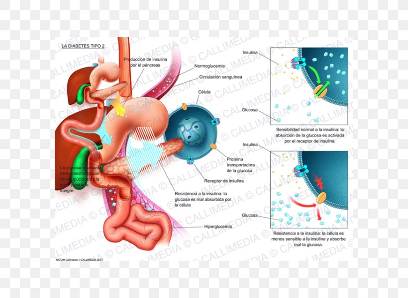 Diabetes Mellitus Type 2 Illustration Internal Medicine Niimi Clinic, PNG, 600x600px, Watercolor, Cartoon, Flower, Frame, Heart Download Free