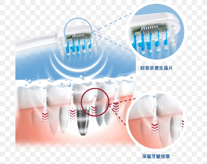 Electric Toothbrush Dentistry Ultrasonic Toothbrush, PNG, 697x649px, Toothbrush, Brush, Cosmetic Dentistry, Dental Water Jets, Dentistry Download Free
