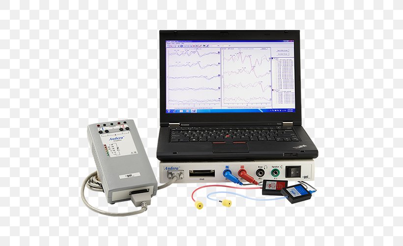 Hearing Loss Brainstem Otoacoustic Emission, PNG, 500x500px, Hearing, Audiology, Audiometer, Audiometry, Auditory System Download Free