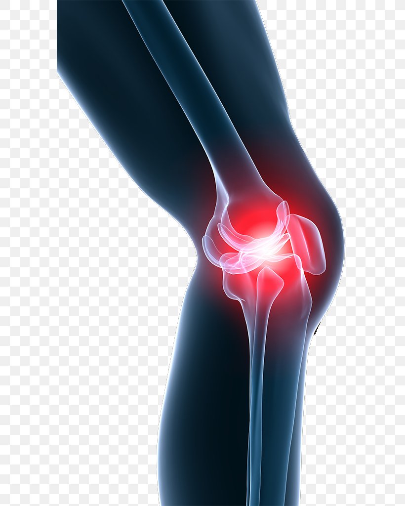 Knee Pain Shoulder Pain Stem-cell Therapy, PNG, 590x1024px, Knee Pain, Ache, Arm, Elbow, Hip Download Free