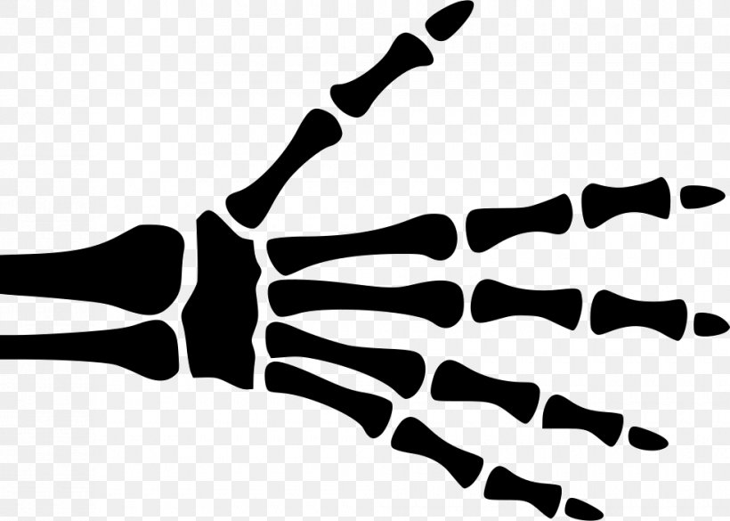 Finger X-ray Hand Carpal Bones, PNG, 980x700px, Finger, Black, Black And White, Bone, Carpal Bones Download Free