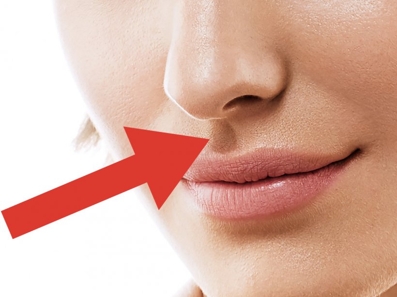 Nose Lip Mouth Face Philtrum, PNG, 1186x889px, Nose, Beauty, Cheek, Chin, Close Up Download Free