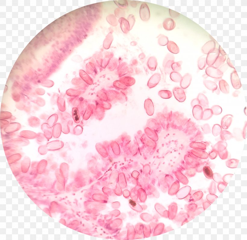 Protist Cyclospora Cayetanensis Adibide Wikipedia Protozoa, PNG, 2396x2336px, Protist, Adibide, Apicomplexa, Coccidiosis, Cyclospora Download Free