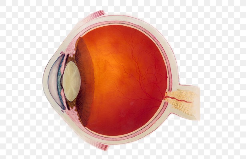 Near-sightedness Human Eye Visual Perception Eye Examination, PNG, 539x532px, Nearsightedness, Amblyopia, Blurred Vision, Disease, Eye Download Free