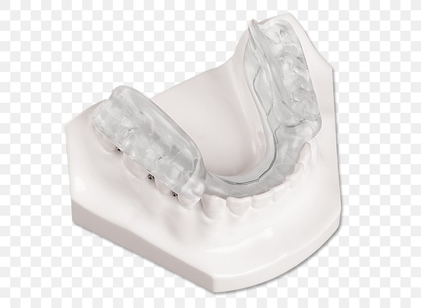 Splint Temporomandibular Joint Dysfunction Jaw Orthotics Twin Block Appliance, PNG, 623x600px, Splint, Bionator, Incisor, Jaw, Maxilla Download Free