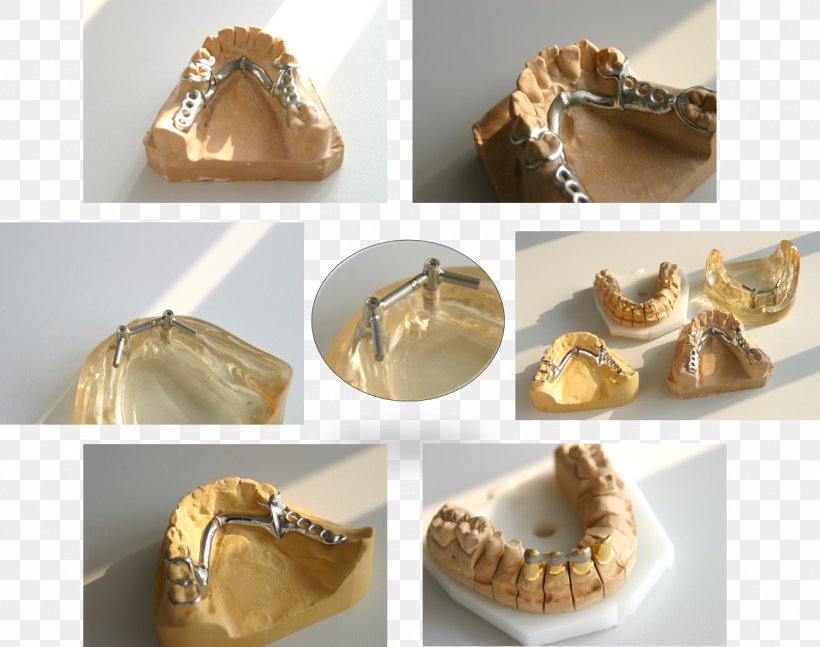 Jaw Shoe, PNG, 1300x1027px, Jaw, Gold, Outdoor Shoe, Shoe Download Free