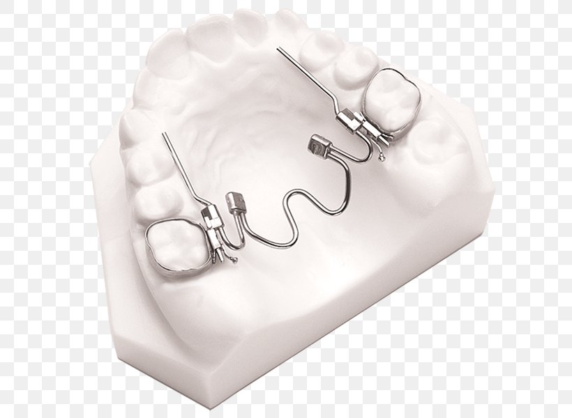 Nickel Titanium Palatal Expansion ResearchGate Material Quad Helix, PNG, 613x600px, Nickel Titanium, Dentistry, Expander Graph, Material, Medical Equipment Download Free