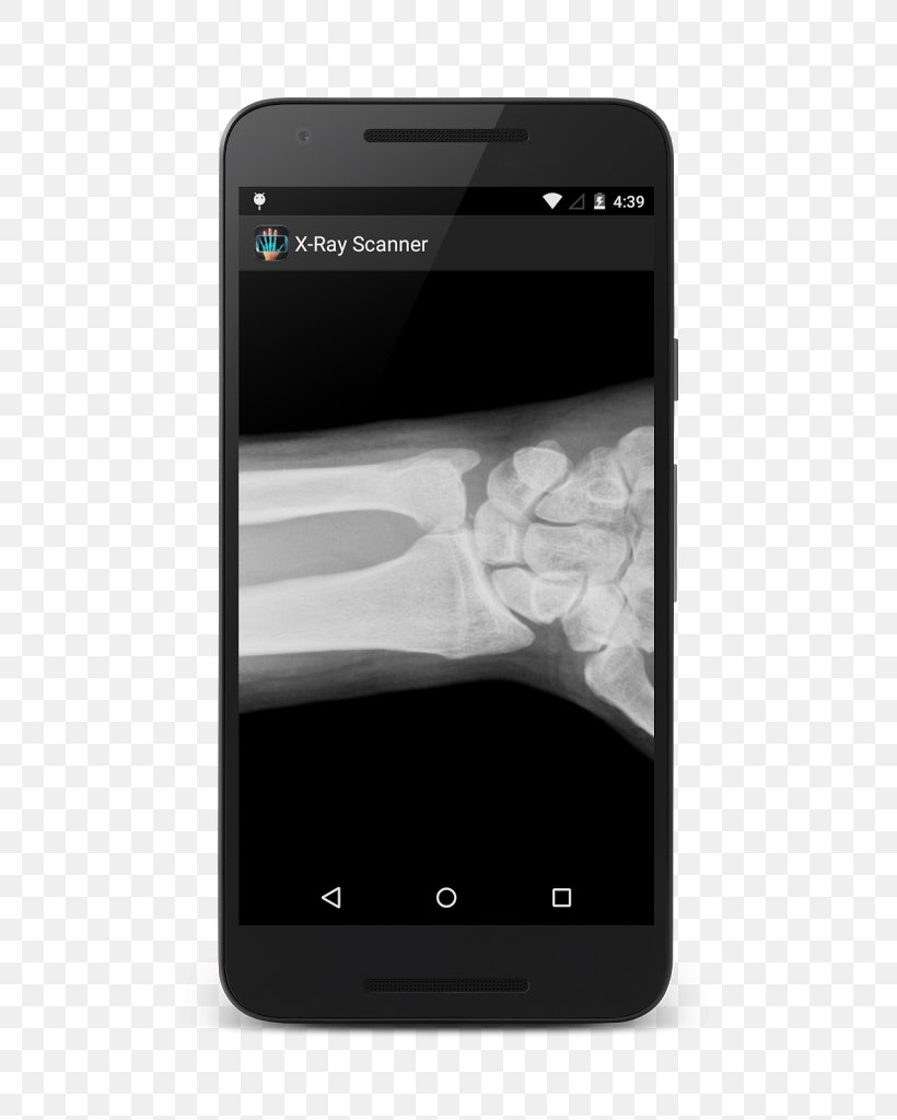 Feature Phone Smartphone IPhone X X-ray Scanner Prank Android, PNG, 597x1024px, Feature Phone, Android, Black And White, Communication Device, Computer Software Download Free